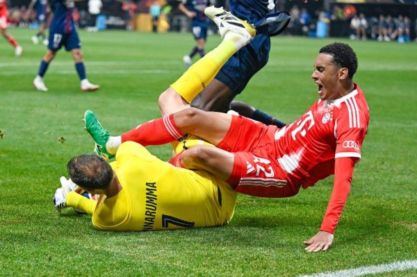 免费配资炒股入 穆西亚拉恐怖伤情: 拜仁10号腓骨骨折, 将休战至11月